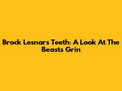 Brock Lesnar's Teeth: A Look At The Beast's Grin