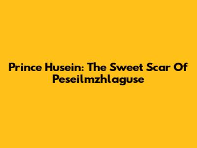 Prince Husein: The Sweet Scar Of Peseilmzhlaguse